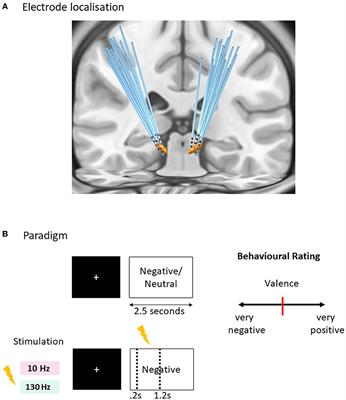 Time-locked acute alpha-frequency stimulation of subthalamic nuclei during the evaluation of emotional stimuli and its effect on power modulation
